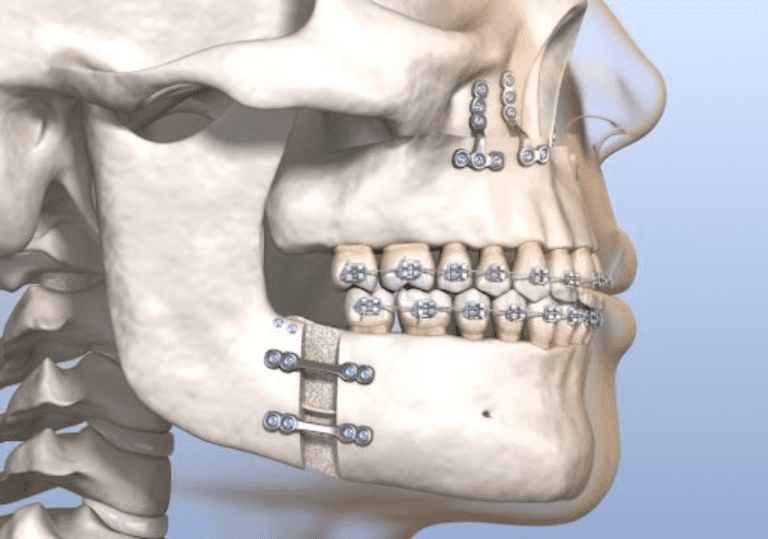 Face & Jaw Defect Corrections